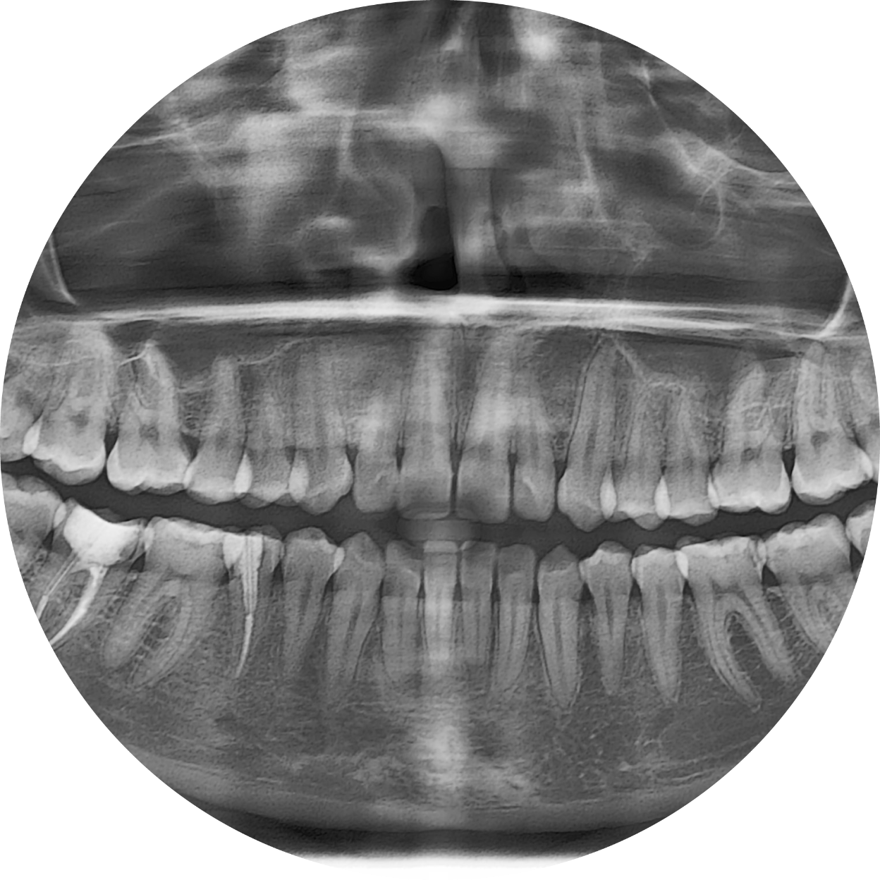 https://jonaclinic.ro/wp-content/uploads/2025/05/radiografie-fotor-20250526144511.png